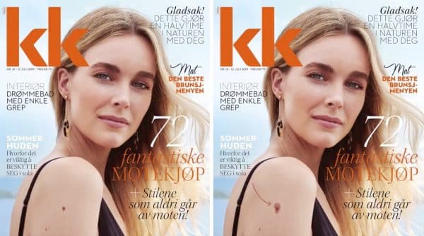 Magazine with unique print solution – puts the spotlight on skin cancer